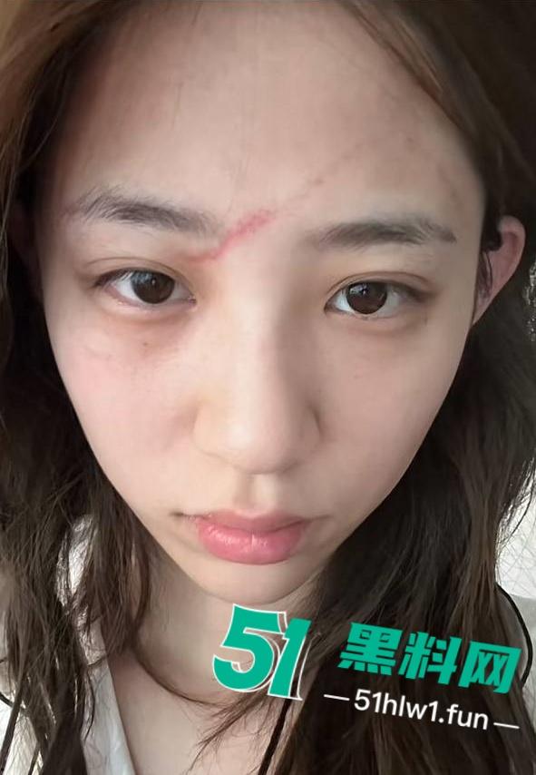 两位抖音百万网红,前CUBA成员【程鑫凯】家暴【鸡腿诺】事件持续发酵,未流出资料曝光完整吃瓜。-31