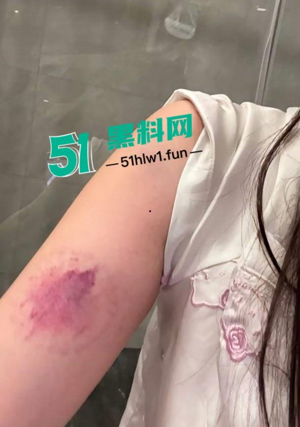 两位抖音百万网红,前CUBA成员【程鑫凯】家暴【鸡腿诺】事件持续发酵,未流出资料曝光完整吃瓜。-39