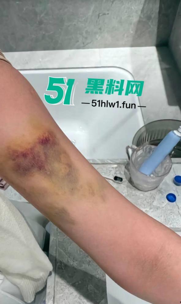 两位抖音百万网红,前CUBA成员【程鑫凯】家暴【鸡腿诺】事件持续发酵,未流出资料曝光完整吃瓜。-42