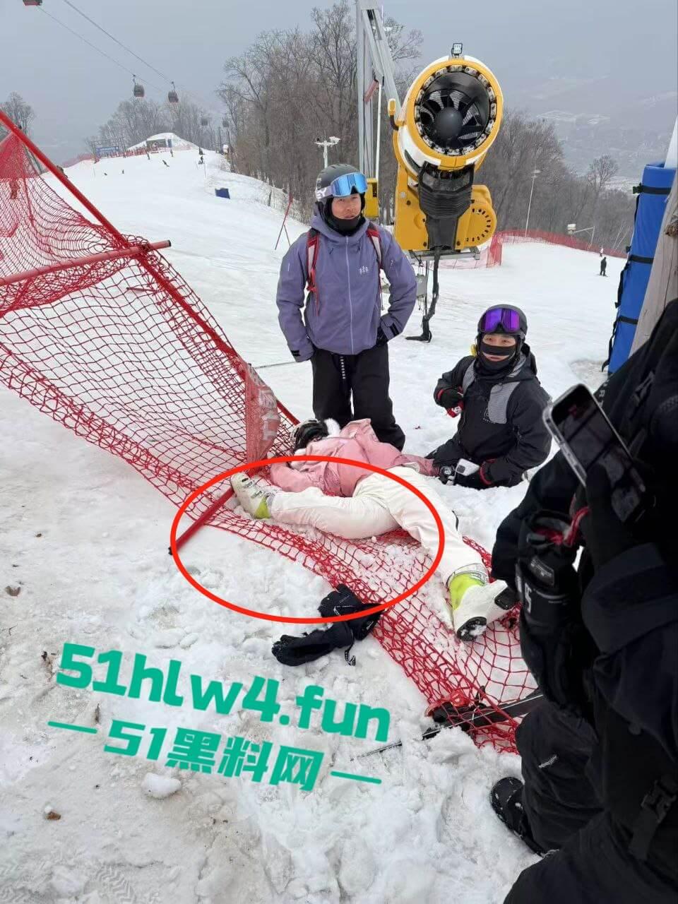 北大湖滑雪场新手滑雪妹，误入中高级滑道滑雪，不慎摔飞被撞到变形断腿场面超吓人。-1