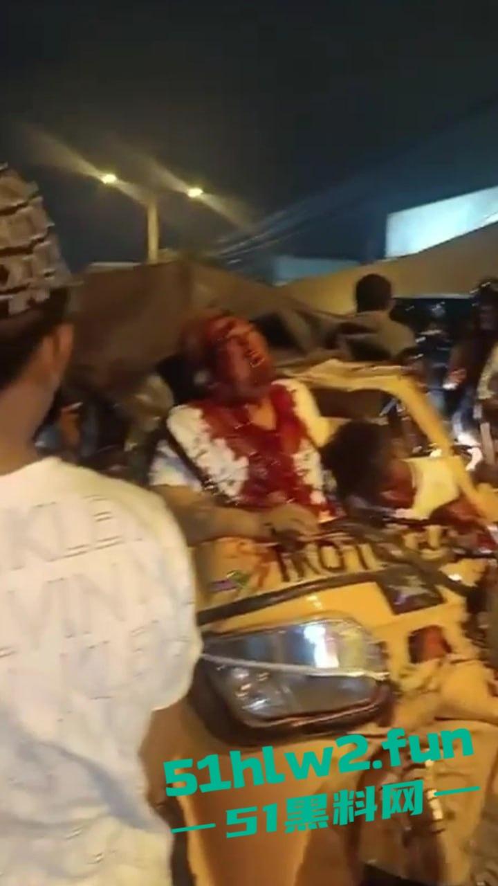 老头乐车祸现场因超速追尾,老头被当场甩出满脸是血,这回老头乐坏了老头也不乐了。-3