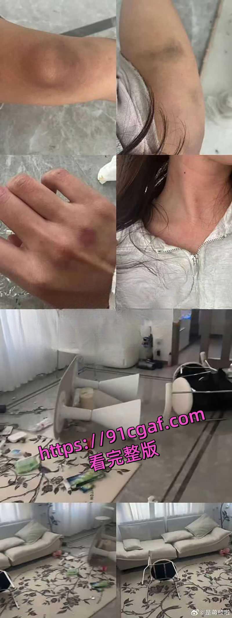 姬圈网红大瓜之女同也出轨家暴!蒋桢曝光杨弋出轨家暴-8