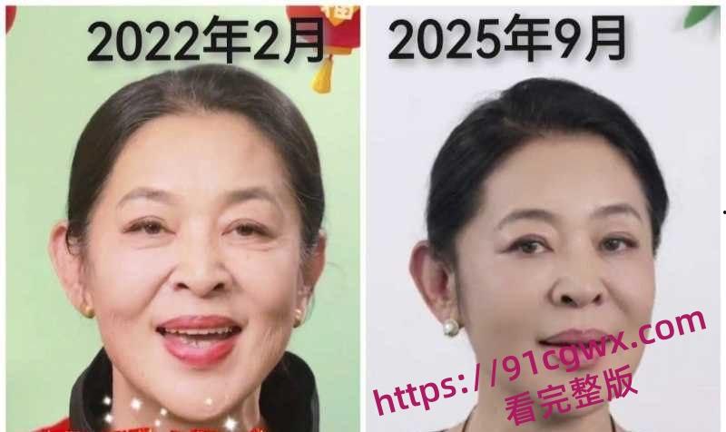 李连杰洪金宝倪萍脱胎换骨 疑似器官移植续命年轻20岁 轮椅变健步黑发红润!-9