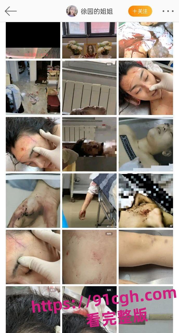 辽宁大连普兰店女孩 徐园 事件再起波澜 男子家中砍死女友 却被无罪释放!-3