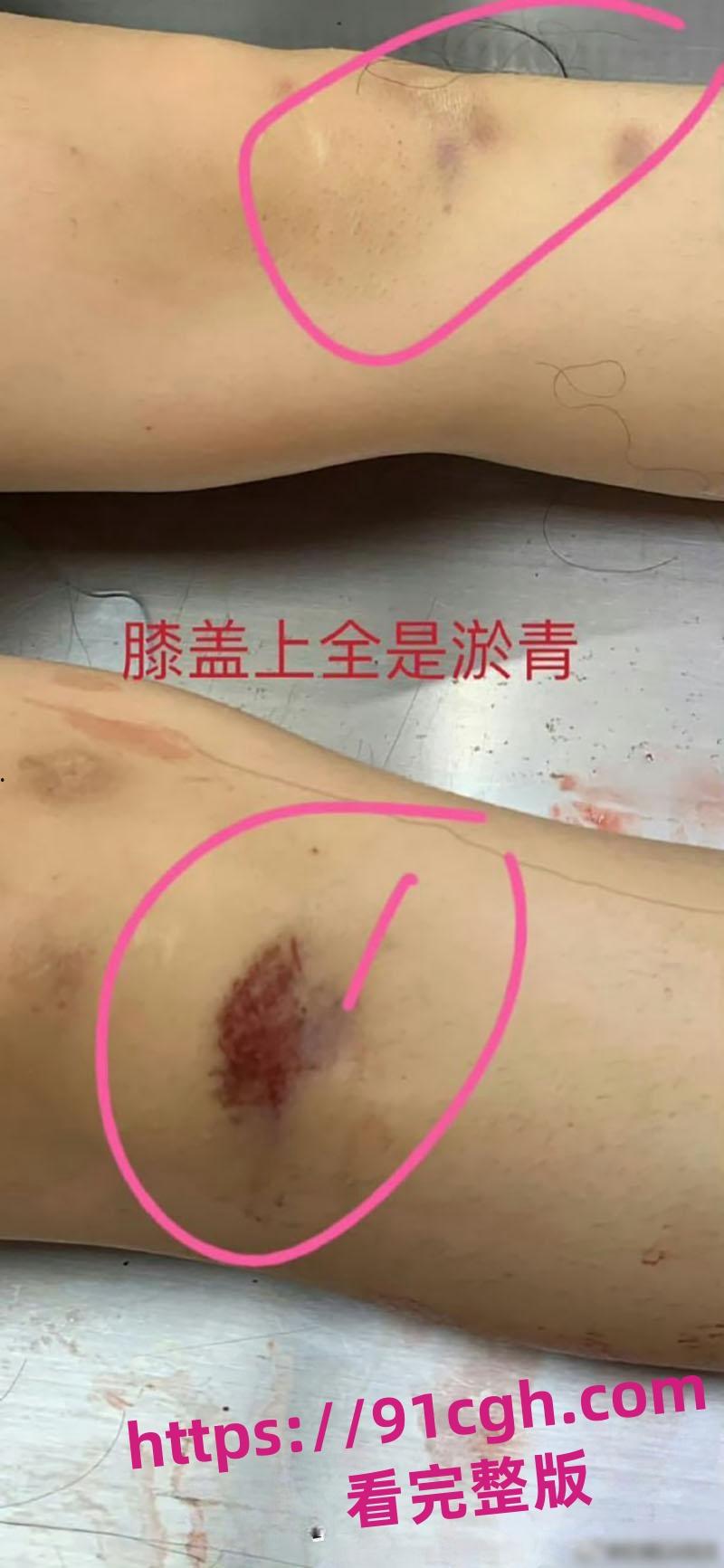 辽宁大连普兰店女孩 徐园 事件再起波澜 男子家中砍死女友 却被无罪释放!-6