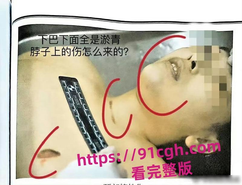 辽宁大连普兰店女孩 徐园 事件再起波澜 男子家中砍死女友 却被无罪释放!-10