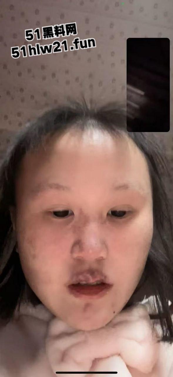 重庆生化母体【刘思婷】美化身份装女神到处卖骚,体生烂疮还继续约炮散毒。-9