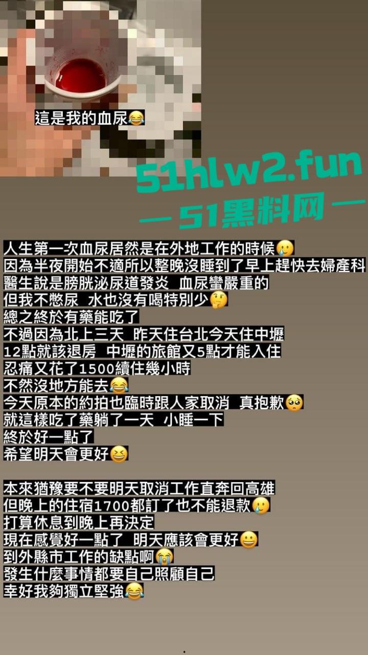 台北老模【Queenie】逆风翻盘,从假奶到写真平台,风衣吊带袜开腿高铁露底,老公心大送妻给全网撸到血尿!-5