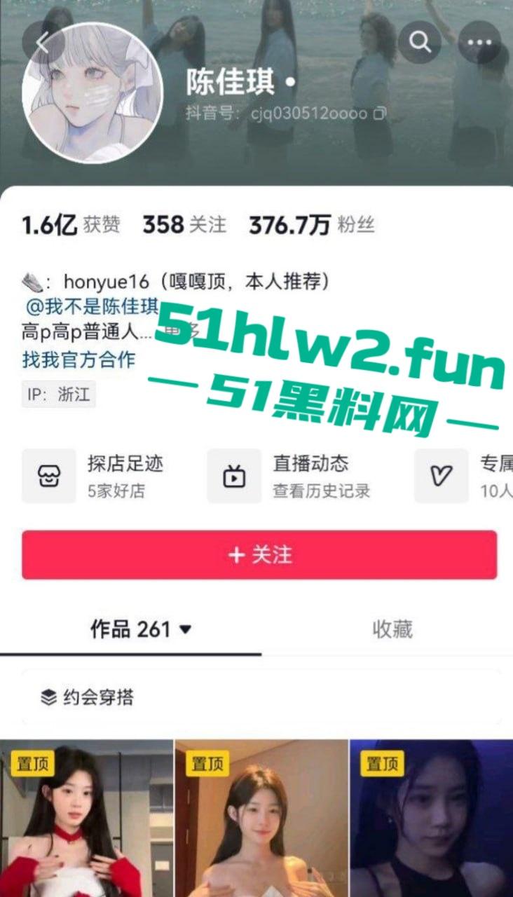 376W粉丝网红【陈佳琪】绝美颜值极品尤物，肌肤白嫩身材一流奶大臀翘腿长逆天直播间抱猫结果惨遭露点。-6