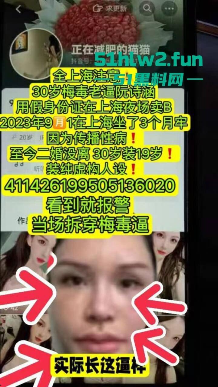 夜场梅毒女【阮诗涵】装嫩卖逼传毒坑害多人，仍在抖音撒网捕鱼专骗老实人全网避雷！-1