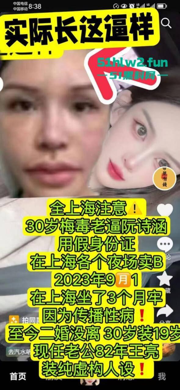 夜场梅毒女【阮诗涵】装嫩卖逼传毒坑害多人，仍在抖音撒网捕鱼专骗老实人全网避雷！-4