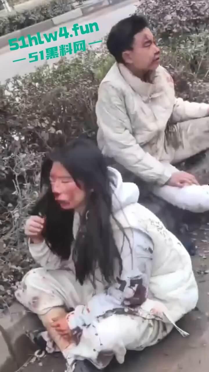 内江资中奇葩车祸五菱宏光加速超车，竟然失控出车祸俩人都变成熊猫脸，看着太搞笑了。-1